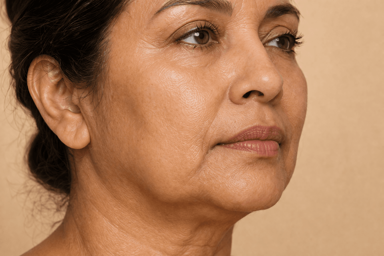 Non-surgical lift and skin-tightening treatment for sagging and loose skin at La Miel Aesthetics medical spa in Raleigh, NC.